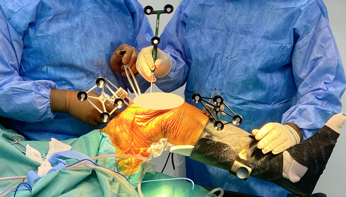 Robotik Diz Protezi Cerrahisi